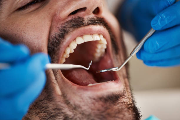 Best Emergency Dental Care for Abscessed Tooth in Newcastle, OK